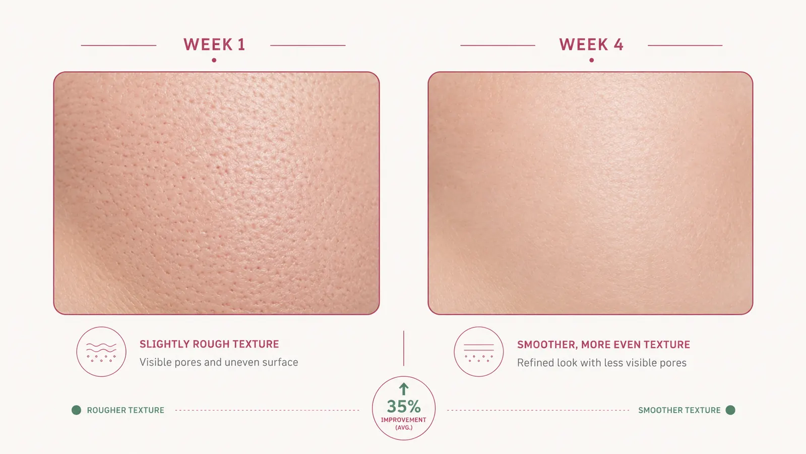 Split-panel showing skin texture before and after four weeks of nightly cream use
